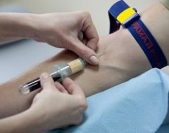 Несколько причин сдать анализ на определение уровня паратгормона